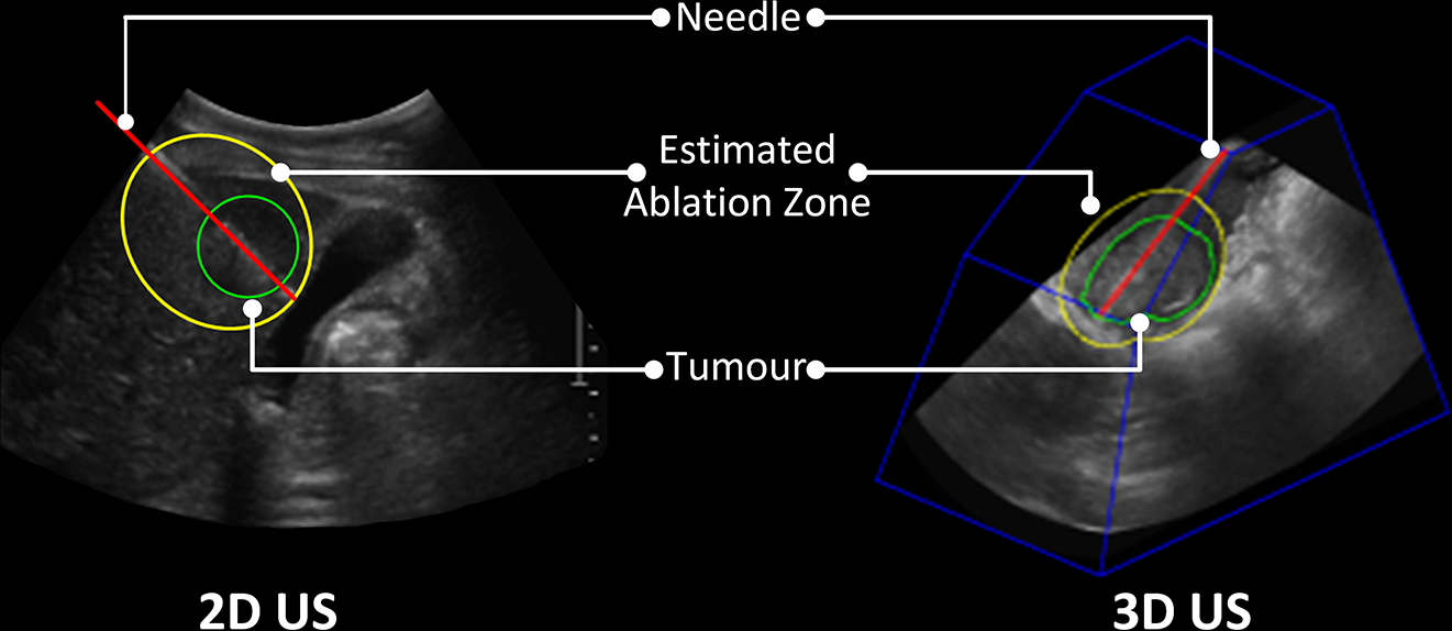 3DLIVUS assessment
