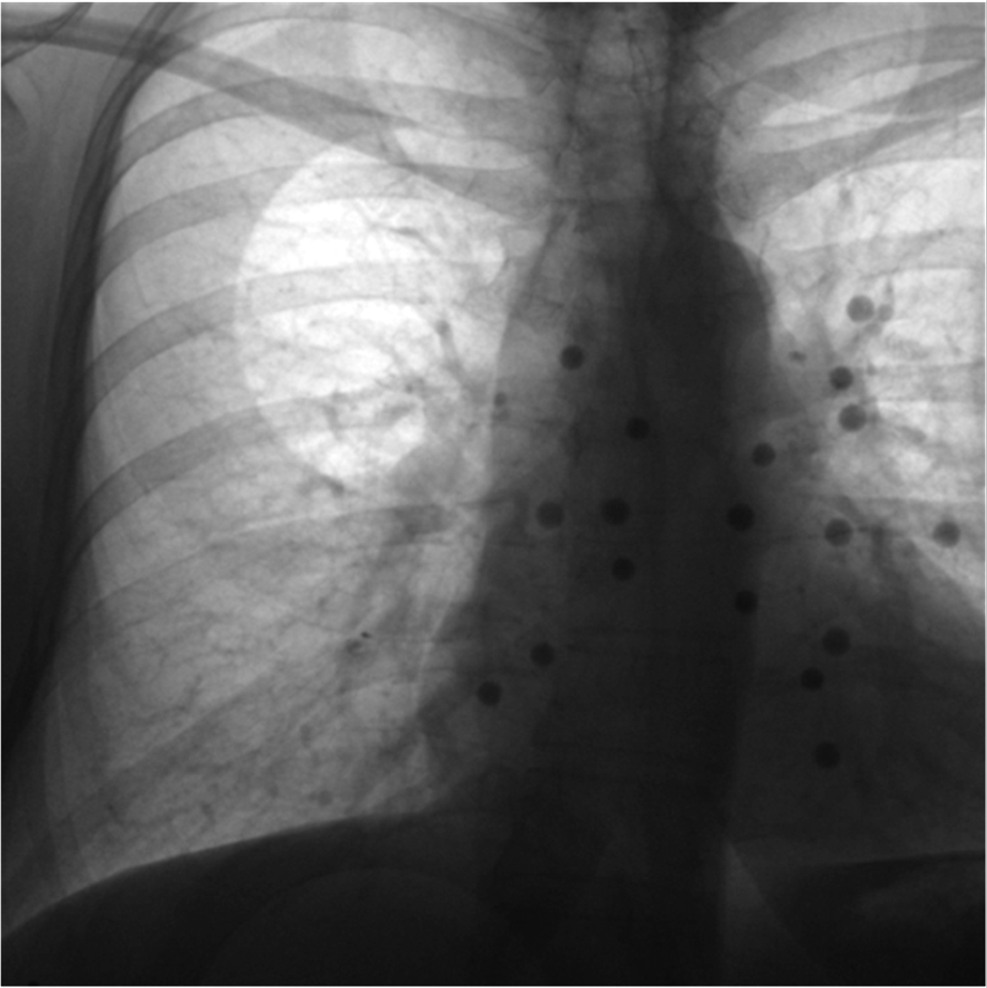 FLUX-NAV image decomposition